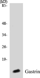 Western blot analysis of extracts from NIH-3T3 cells, using Gastrin Antibody.