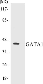 Western blot analysis of extracts from COLO cells, using GATA1 (Ab-142) Antibody.