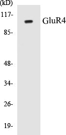 Western blot analysis of extracts from NIH-3T3 cells, treated with Forskolin 40nM 30', using GluR4 (Ab-862) Antibody.