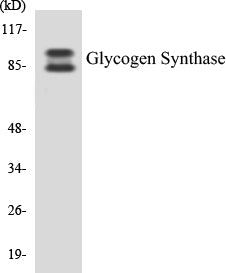 Western blot analysis of extracts from HeLa cells, treated with Serum 20% 30', using Glycogen Synthase (Ab-645) Antibody.