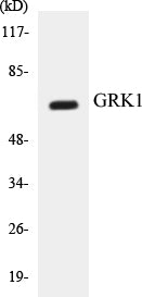 Western blot analysis of extracts from COLO205 cells, using GRK1 (Ab-21) Antibody.