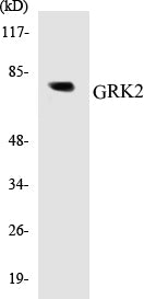 Western blot analysis of extracts from Jurkat cells, using GRK2 (Ab-685) Antibody.