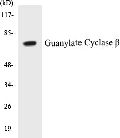 Western blot analysis of extracts from HuvEc cells, using Guanylate Cyclase beta Antibody.