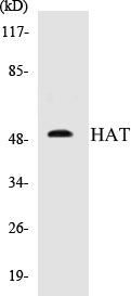 Western blot analysis of extracts from K562 cells, using HAT Antibody.