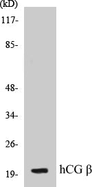 Western blot analysis of extracts from NIH-3T3 cells, using hCG beta Antibody.