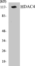 Western blot analysis of extracts from HeLa/Jurkat cells, using HDAC4 (Ab-632) Antibody.