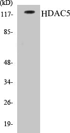 Western blot analysis of extracts from HepG2 cells, using HDAC5 (Ab-259) Antibody.