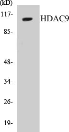 Western blot analysis of extracts from HepG2 cells, using HDAC9 Antibody.