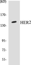 Western blot analysis of extracts from HepG2 cells, using EPHB1/2 (Ab-594/604) Antibody.