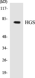 Western blot analysis of extracts from 293/COLO/HuvEc cells, using HRS (Ab-334) Antibody.