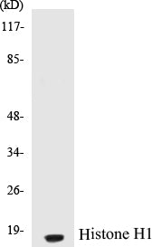 Western blot analysis of extracts from COLO cells, using Histone H1 (Ab-17) Antibody.