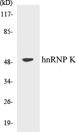 Western blot analysis of extracts from K562/A549/HT-29 cells, using hnRNP K (Ab-284) Antibody.