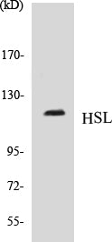 Western blot analysis of extracts from COLO/MCF7 cells, using HSL (Ab-552) Antibody.