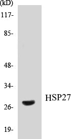 Western blot analysis of extracts from HeLa cells, using HSP27 (Ab-15) Antibody.