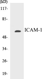 Western blot analysis of extracts from HepG2 cells, using ICAM-1 (Ab-512) Antibody.