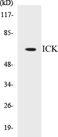 Western blot analysis of extracts from NIH-3T3 cells, treated with PBS 10uM 60', using ICK (Ab-159) Antibody.