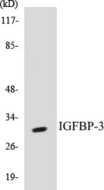 Western blot analysis of extracts from RAW246.7 cells, using IGFBP-3 (Ab-183) Antibody.