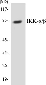 Western blot analysis of extracts from Jurkat cells, using IKK-alpha/beta (Ab-176/177) Antibody.