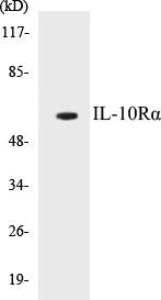 Western blot analysis of extracts from HepG2 cells, treated with Na2VO3 0.3nM 40', using IL-10R alpha (Ab-496) Antibody.