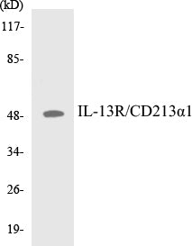 Western blot analysis of extracts from COLO/HT-29/A549/293 cells, using IL-13R/CD213 alpha1 (Ab-405) Antibody.