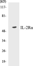 Western blot analysis of extracts from LOVO cells, using IL-2R alpha/CD25 (Ab-268) Antibody.