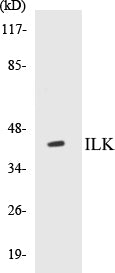 Western blot analysis of extracts from rat liver cells, using ILK (Ab-246) Antibody.