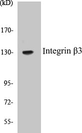 Western blot analysis of extracts from HepG2 cells, using Integrin beta3 (Ab-773) Antibody.