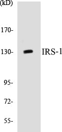 Western blot analysis of extracts from NIH-3T3 cells, using IRS-1 (Ab-312) Antibody.