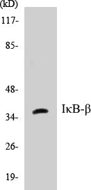 Western blot analysis of extracts from NIH-3T3 cells, treated with TNF 20ng/ml 30', using IkappaB-beta (Ab-19) Antibody.