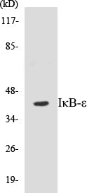 Western blot analysis of extracts from HeLa cells, treated with TNF-a 20ng/ml 5', using IkappaB-epsilon (Ab-22) Antibody.