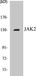 Western blot analysis of extracts from HT-29 cells, using JAK2 (Ab-1007) Antibody.
