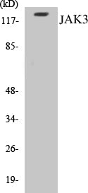 Western blot analysis of extracts from Jurkat cells, using JAK3 (Ab-785) Antibody.