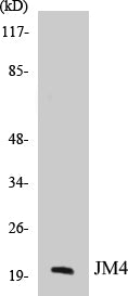 Western blot analysis of extracts from LOVO cells, using JM4 Antibody.