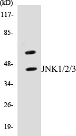 Western blot analysis of extracts from 293 cells, treated with UV 5', using JNK1/2/3 (Ab-183/185) Antibody.