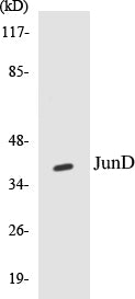 Western blot analysis of extracts from Jurkat cells, using JunD (Ab-255) Antibody.