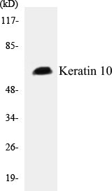 Western blot analysis of extracts from HeLa cells, using Keratin 10 Antibody.