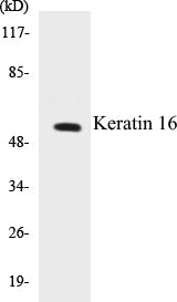 Western blot analysis of extracts from HepG2 cells, using Keratin 16 Antibody.
