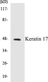 Western blot analysis of extracts from HuvEc cells, using Keratin 17 Antibody.