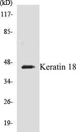 Western blot analysis of extracts from HeLa cells, treated with UV 5', using Keratin 18 (Ab-33) Antibody.