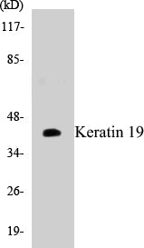 Western blot analyzes of Cytokeratin 19 antibody in extracts from K562 cells.