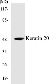 Western blot analysis of extracts from HeLa cells, using Keratin 20 Antibody.
