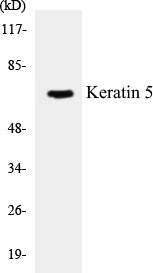 Western blot analysis of extracts from HepG2 cells, using Keratin 5 Antibody.