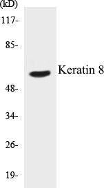 Western blot analysis of extracts from 293 cells, treated with EGF 200ng/ml 30', using Keratin 8 (Ab-431) Antibody.