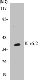Western blot analysis of extracts from 3T3 cells, using Kir6.2 (Ab-224) Antibody.
