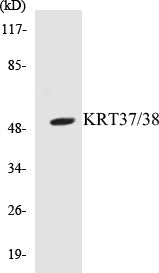 Western blot analysis of the lysates from HepG2 cells using KRT37/38 antibody.