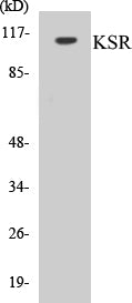 Western blot analysis of extracts from NIH-3T3 cells, treated with PDGF 50ng/ml 20', using KSR (Ab-392) Antibody.