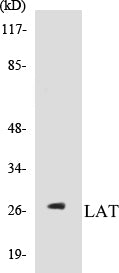 Western blot analysis of extracts from NIH-3T3 cells, using LAT (Ab-191) Antibody.