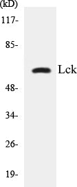 Western blot analysis of extracts from Jurkat cells, using Lck (Ab-192) Antibody.