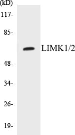 Western blot analysis of extracts from NIH-3T3 cells, treated with UV, using LIMK2 (Ab-505) Antibody.