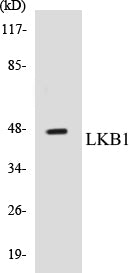 Western blot analysis of extracts from HeLa cells, treated with Serum 20% 15', using LKB1 (Ab-189) Antibody.
